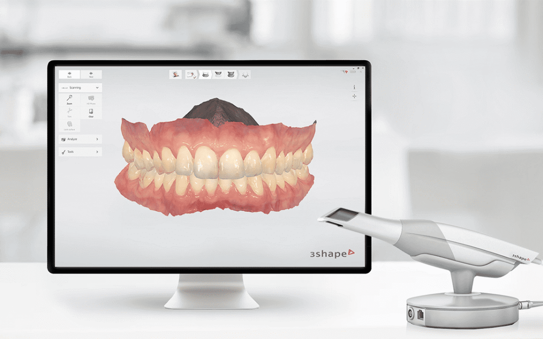 3D Dental Screening