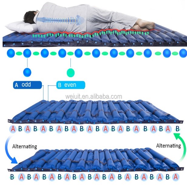 ANTI BEDSORE AND DECUBITUS MATRESS